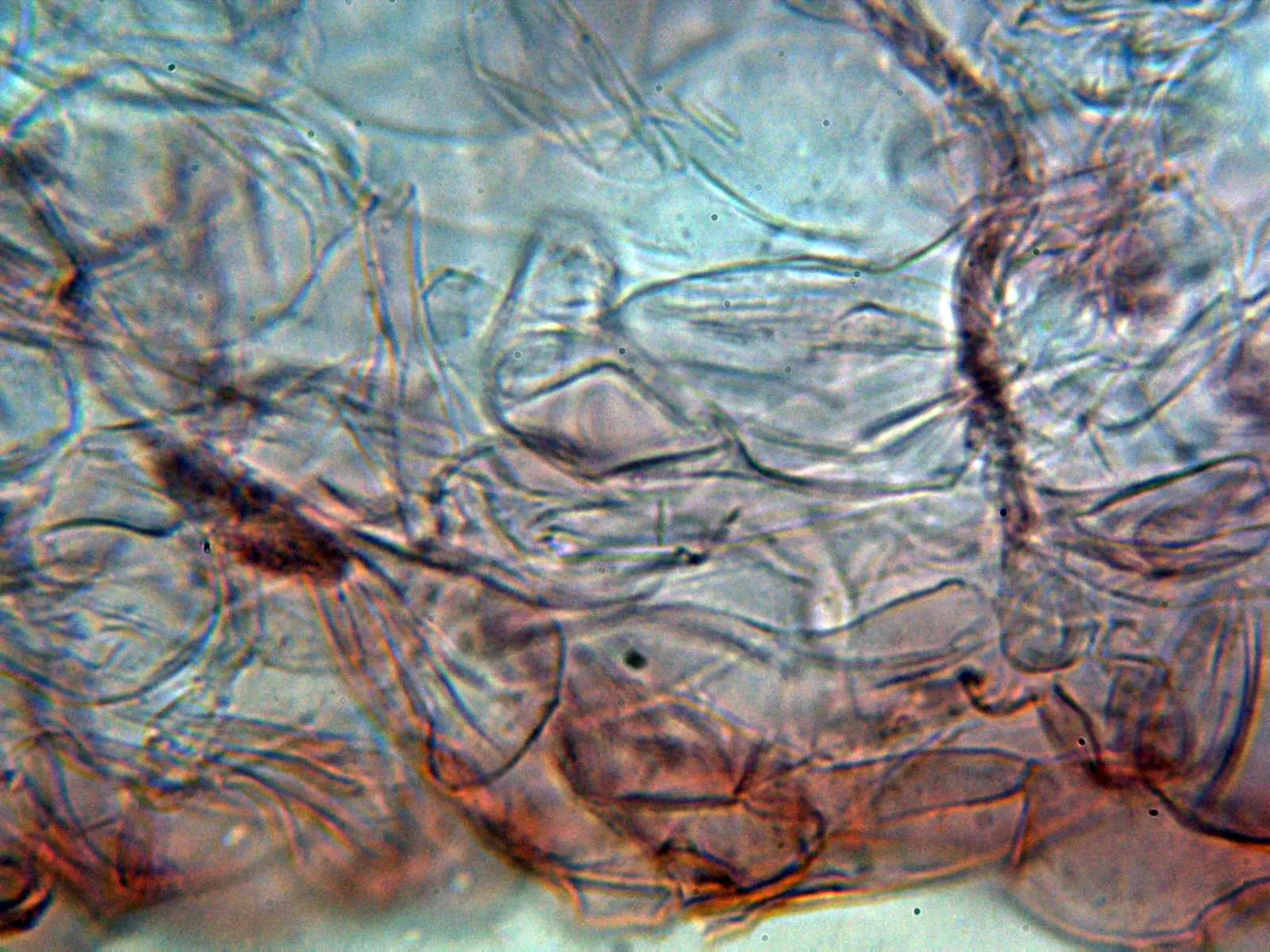 Microscopía de Lycoperdon excipuliforme - 10 - Peridio interno